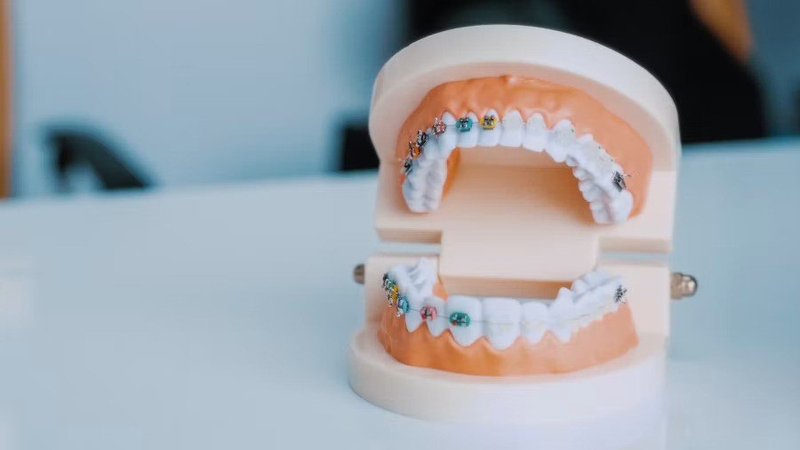 Odontología Estética